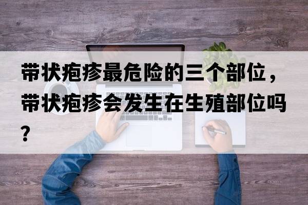 帶狀皰疹最危險的三個(gè)部位，帶狀皰疹會(huì )發(fā)生在生殖部位嗎？