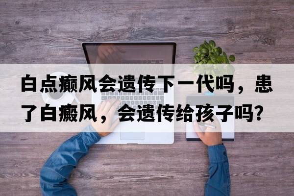 白點(diǎn)癲風(fēng)會(huì )遺傳下一代嗎，患了白癜風(fēng)，會(huì )遺傳給孩子嗎？